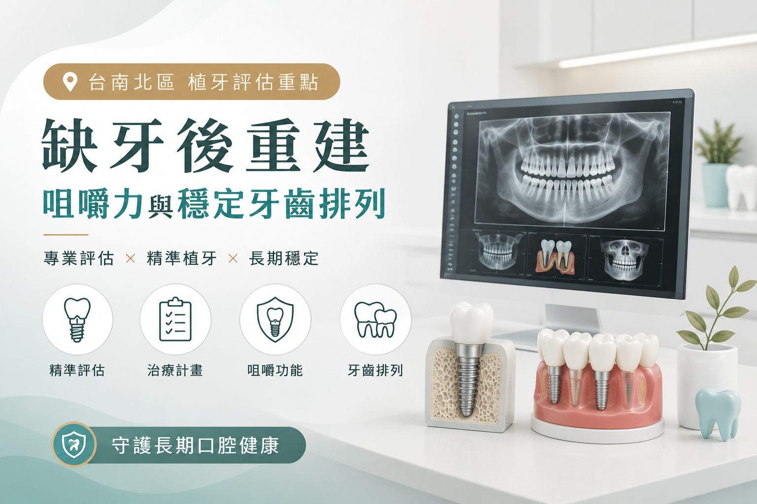 台南北區植牙評估重點：缺牙後重建咀嚼力與穩定牙齒排列